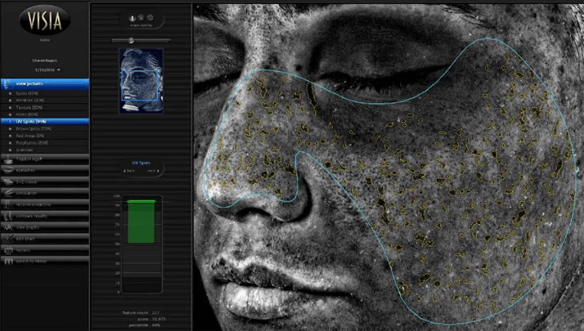 UVシミ/隠れシミ（茶色シミ）解析機能