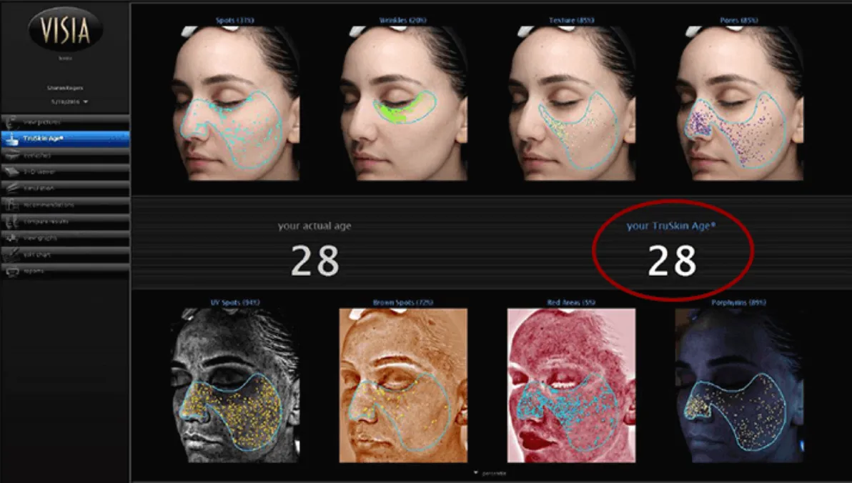 皮膚年齢解析(tru skin age)