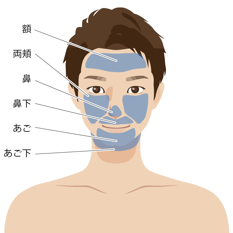 メンズ脱毛（顔脱毛）範囲