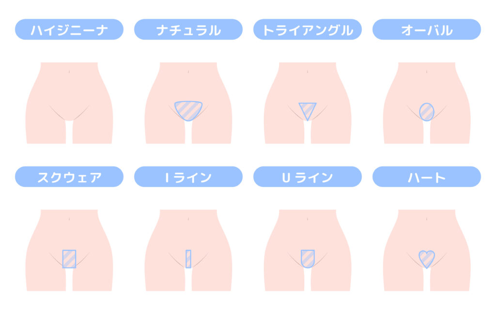 人気のVIOデザインとデザインの決め方